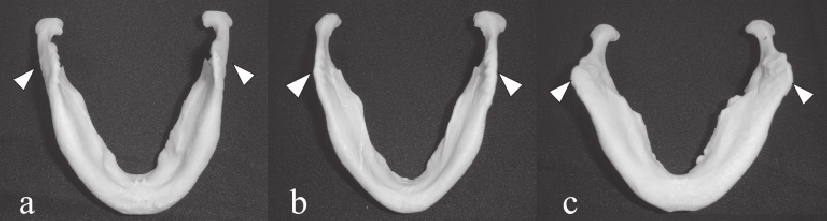 Inverted mandibles show three types of the gonial angle indicated by arrowheads a and