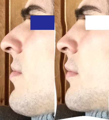 2017 01 24 064023