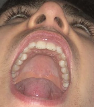 1646953029154