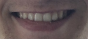 1646954936491