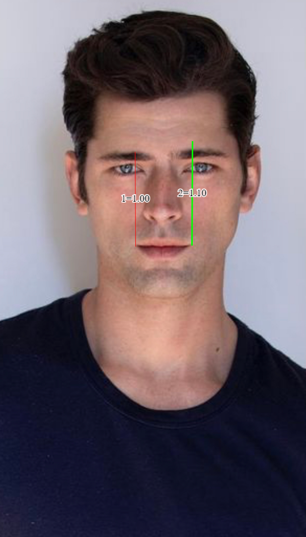 2791159 9AF9F5C6 1416 430C 909C 0F7B41B06CF1 measure00