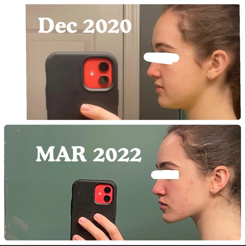 1647182786763
