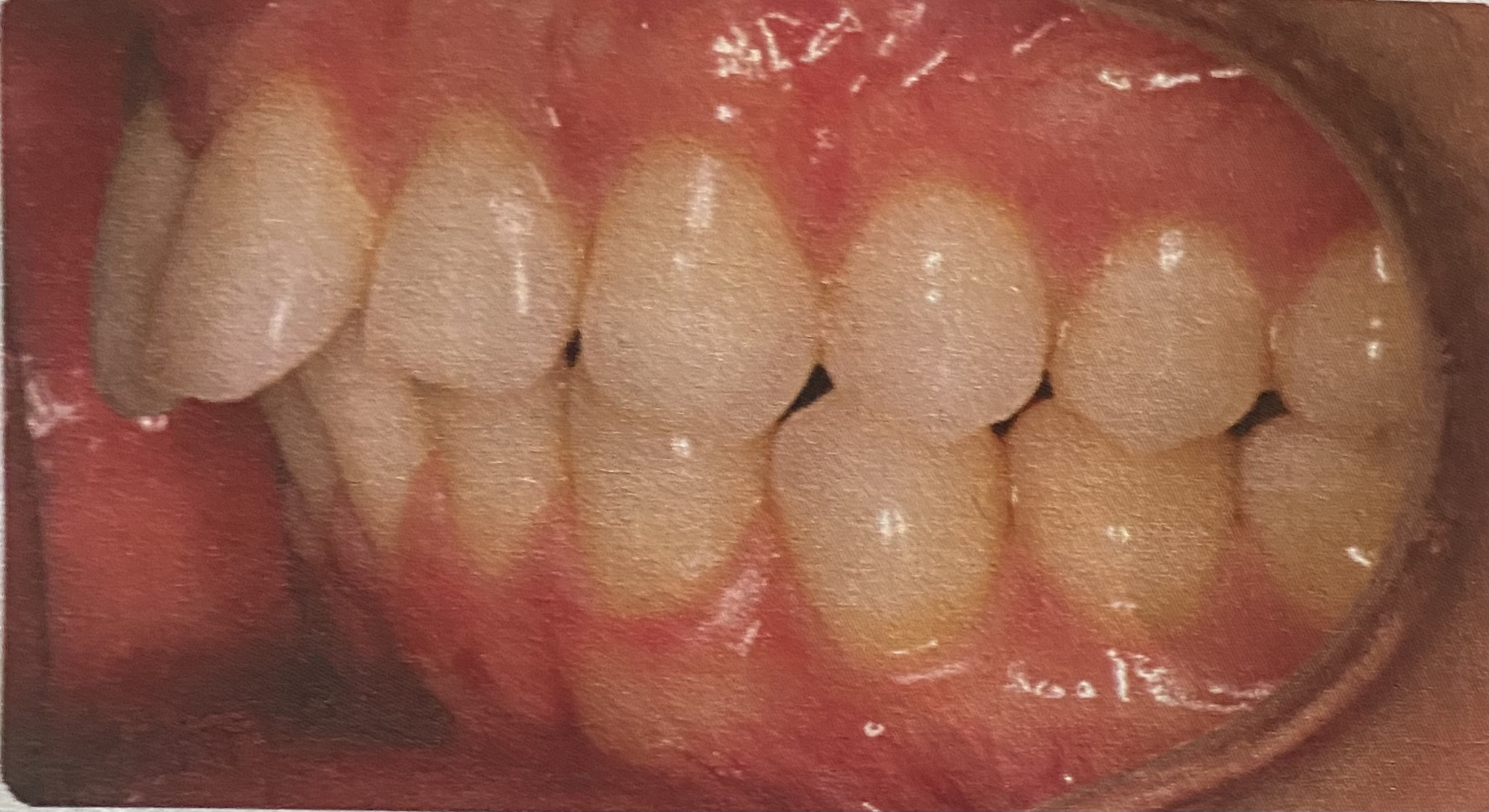 1BB4E5A7 A6E0 4A51 9EFA A78DB1207B7A