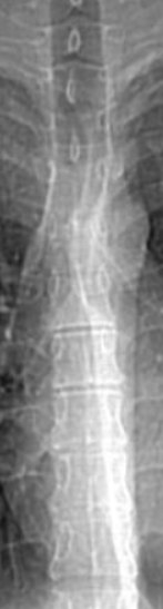 Spinelol2