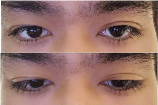 ahk cu eyelashes looksmax.org How do you make your eyelashes point downward like this? | Looksmax.org