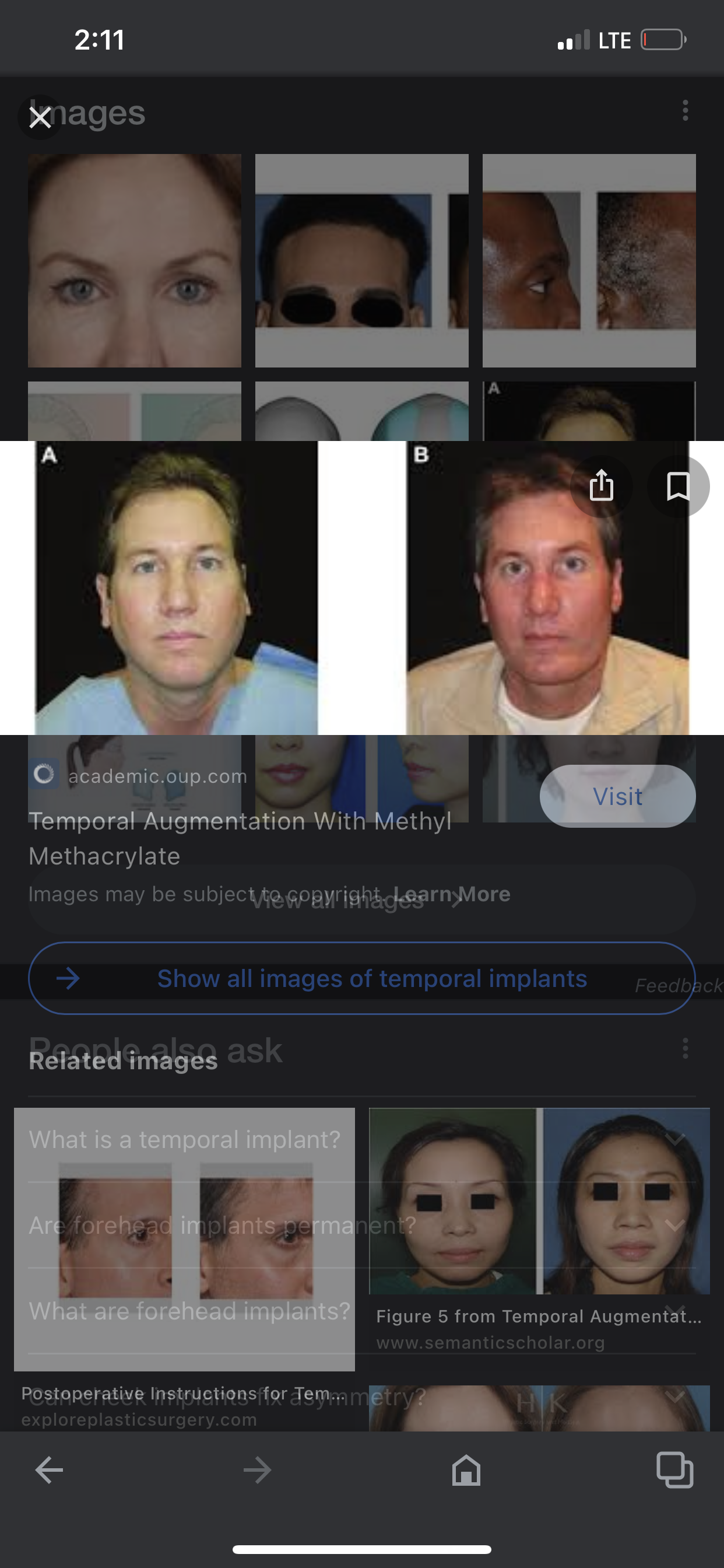 A57F9BF3 3D66 472E 8F35 39ECE4A93E32