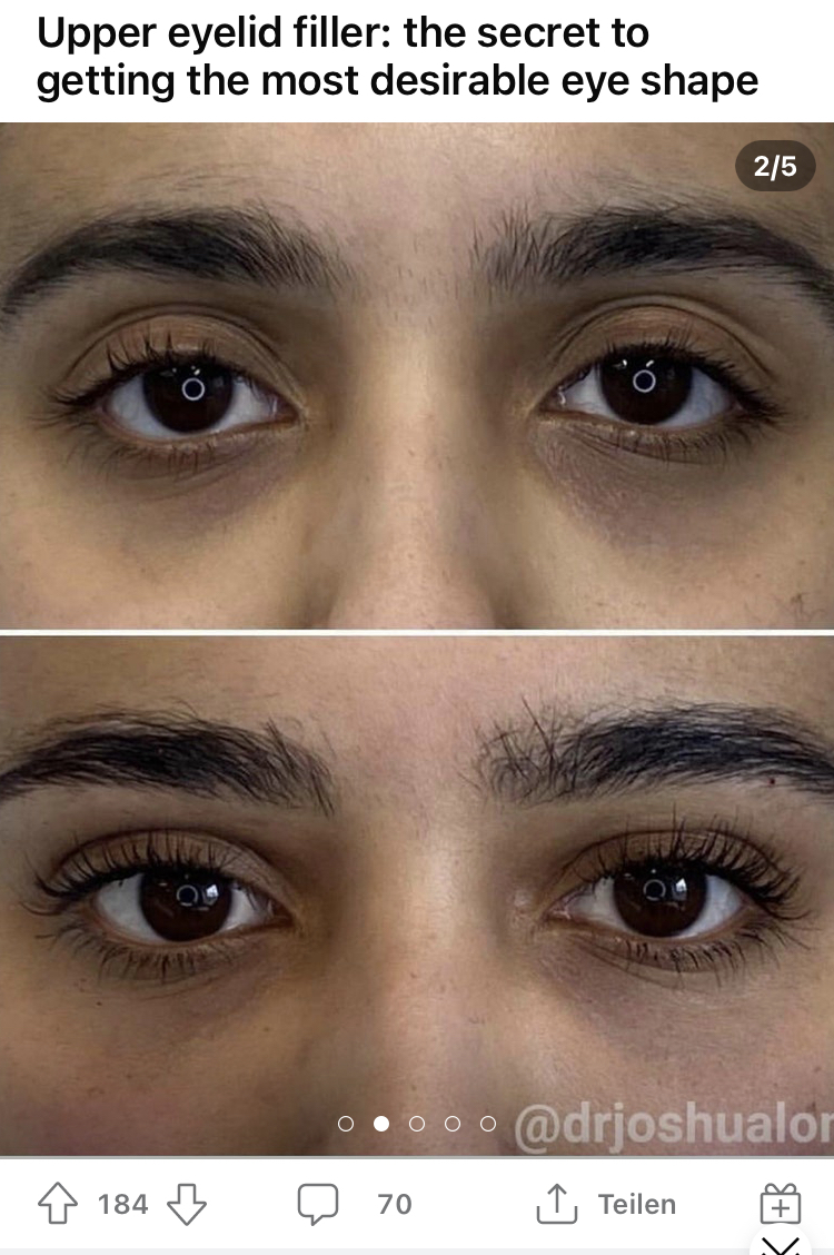 E2992AB5 AD33 4E99 BF91 CC9BD15B5A7D