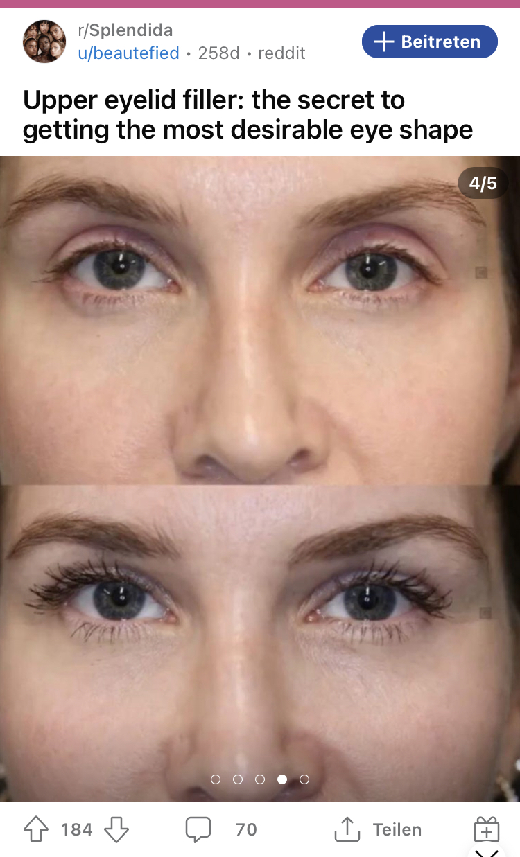 408B541B 2202 4DF8 B52D B9D2E17BDA01