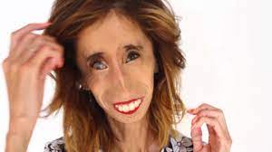 The Ugliest Woman in the World Shares What Makes Her Feel Beautiful  (VIDEO) | Allure