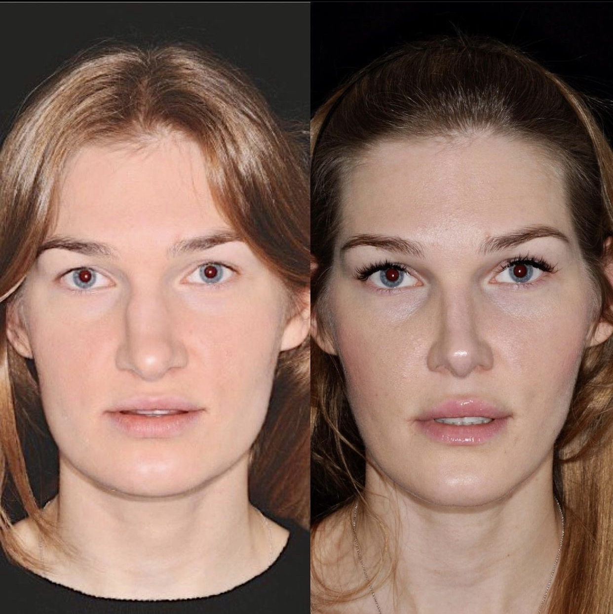 9CCF3E97 25A3 4531 90E6 81D256249C76