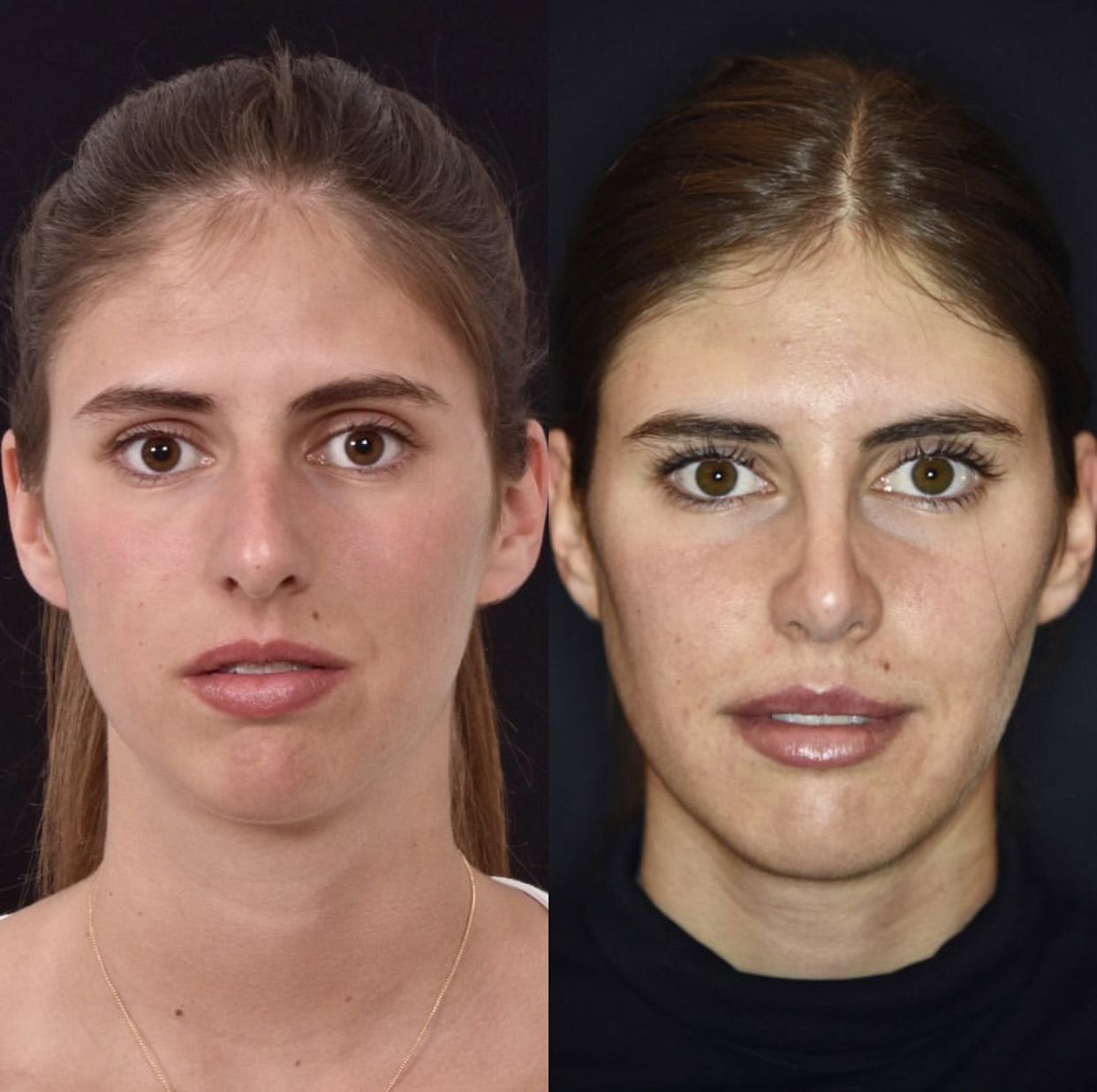 58913787 CD8D 44C6 9C7D CE1CBDE23A59