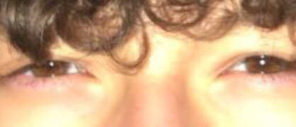 Eye