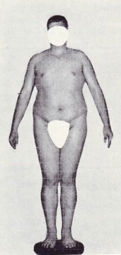 Body endo