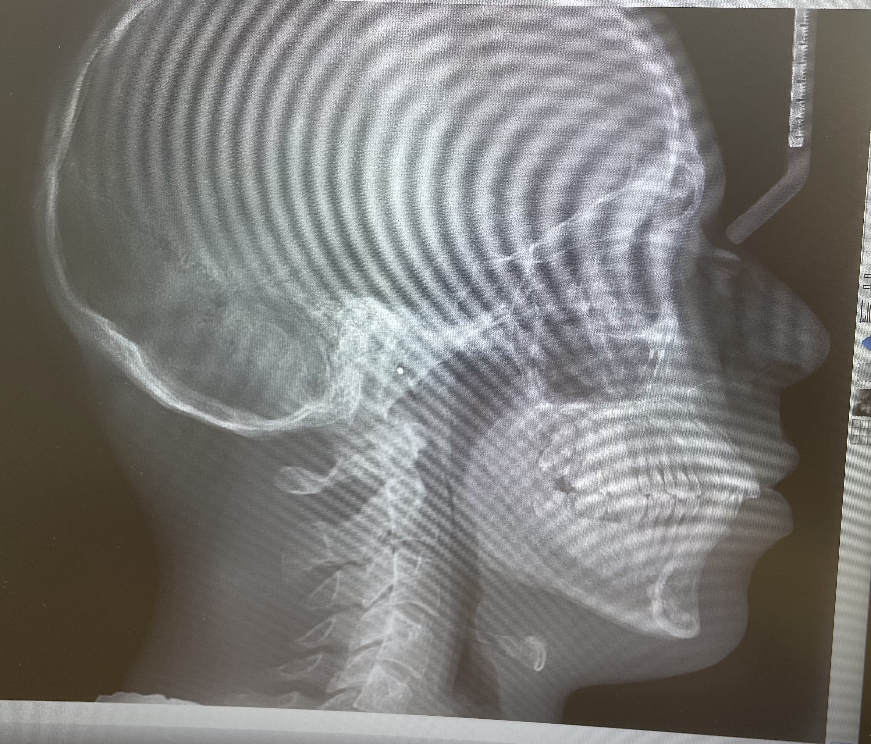 0DF72BEF D3C9 4C64 8BCA EAE48653A3CB