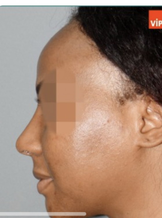 36AB5679 8325 4FE2 A876 E501D398E9B7