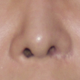 Alarbasescarring1