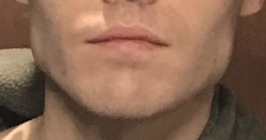 Lips
