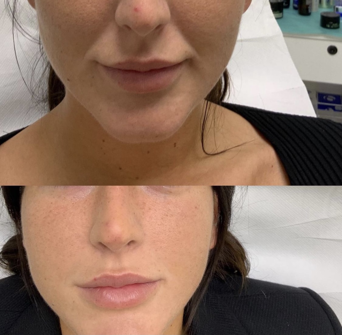 29FCEFCE BC04 45CD B1E0 4D85CC18EAB5