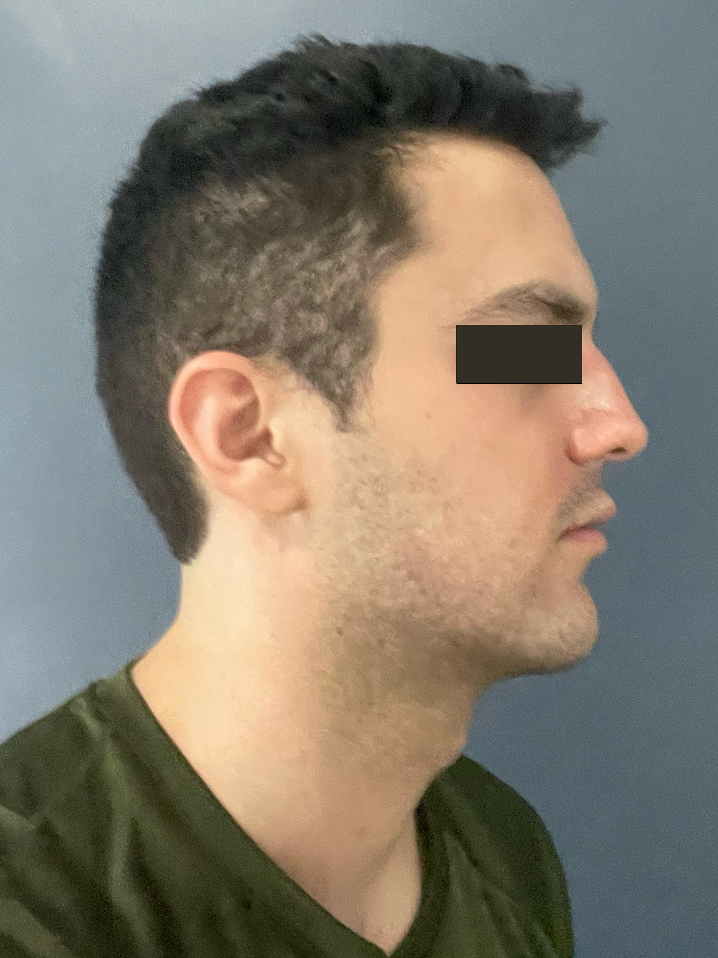 Lateral2