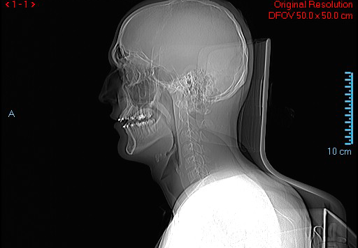 2790629 ctscan