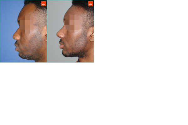 1650076299909