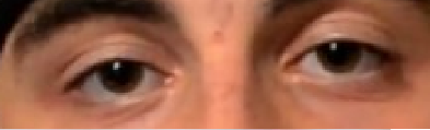 Hunter Vs Prey Eyes