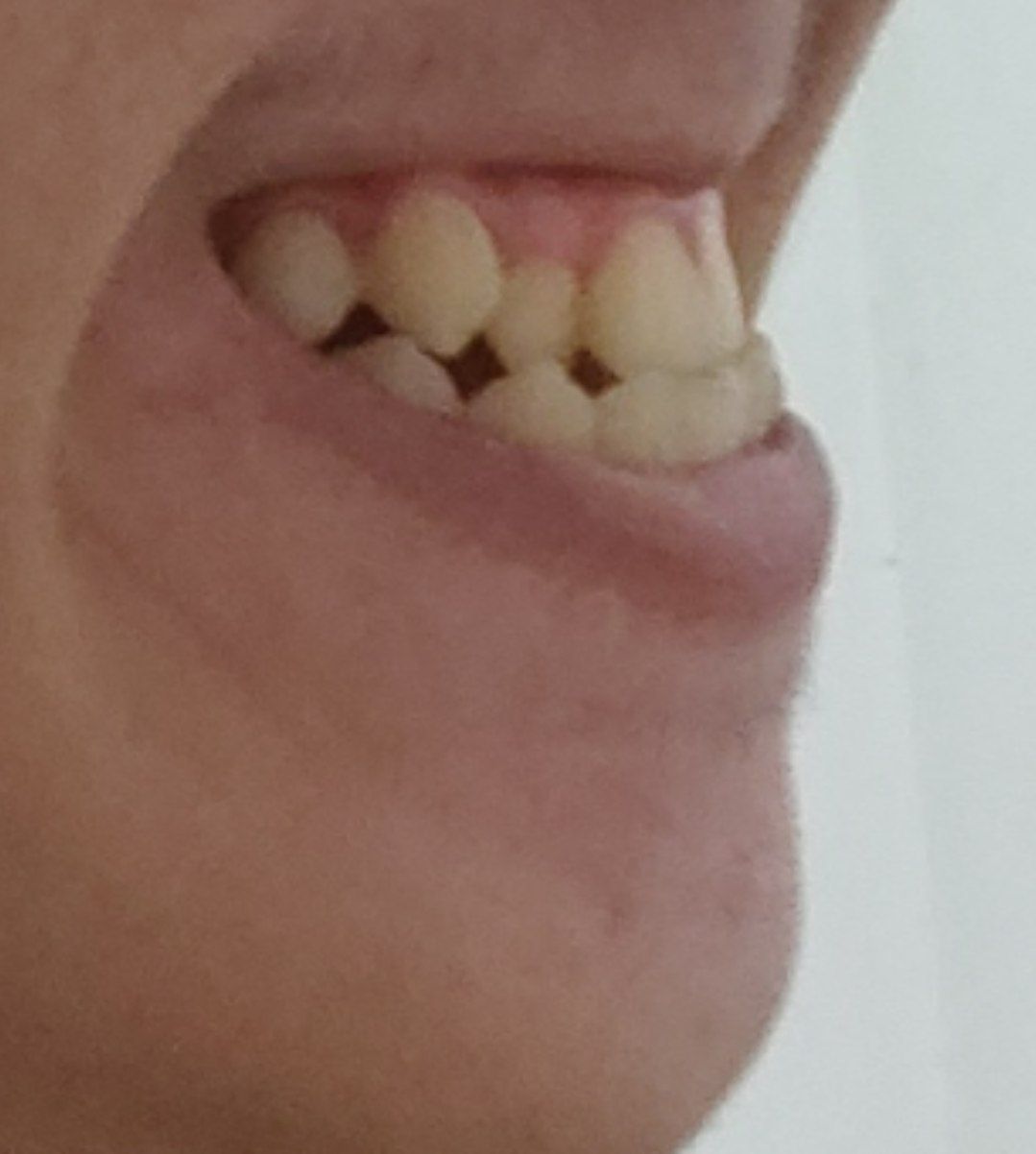 IMG 20220402 124119 346