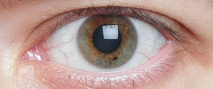 Eye