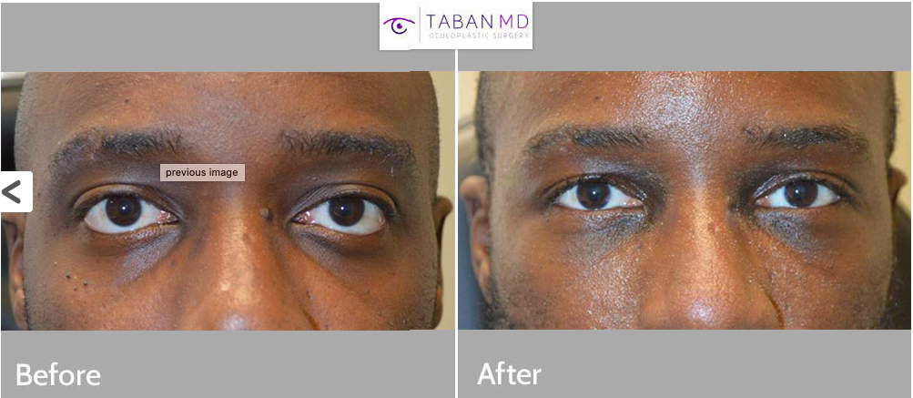 Tabanmd 6