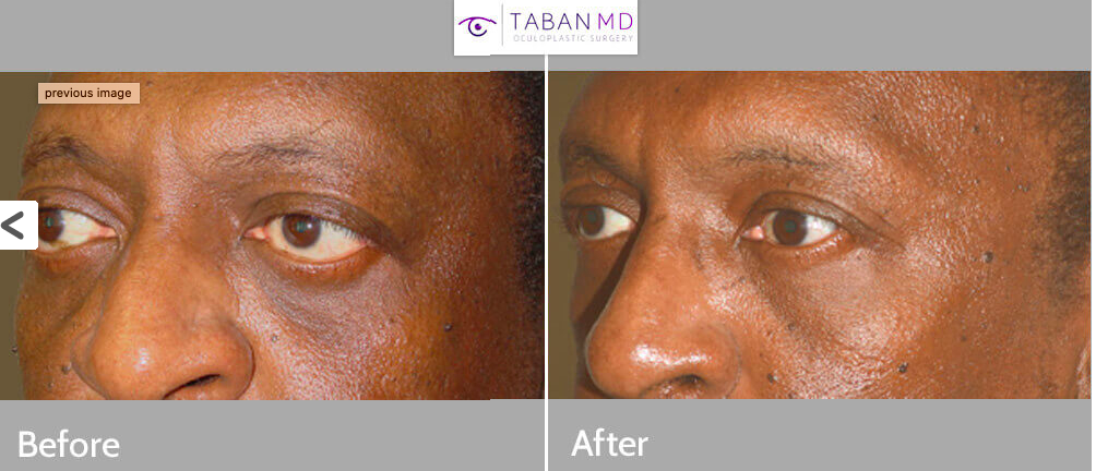 Tabanmd 5