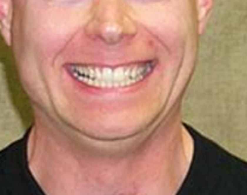 Jaw
