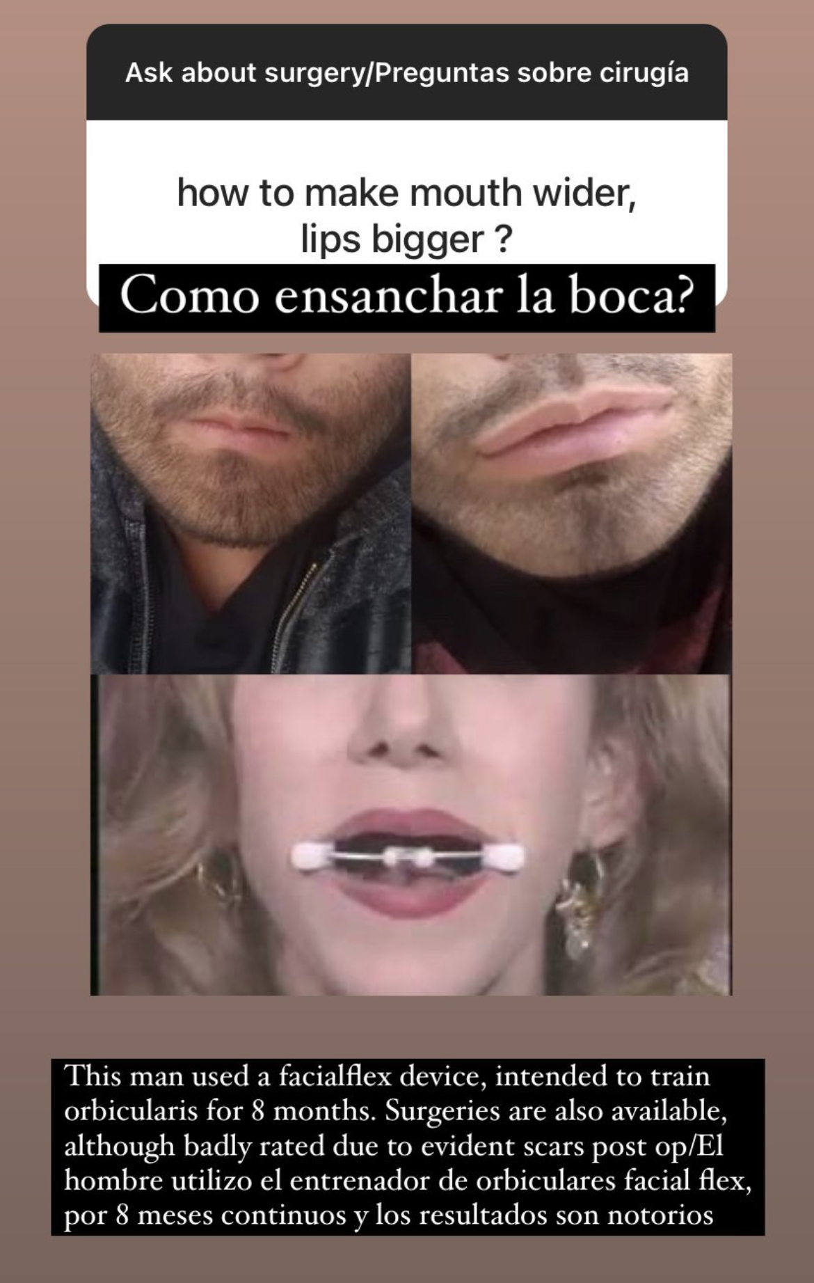 42E97FCE 608A 409A 8EE3 6FD57D0F7439