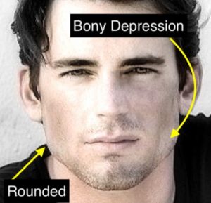 Male strong jaw angles front view 300x289