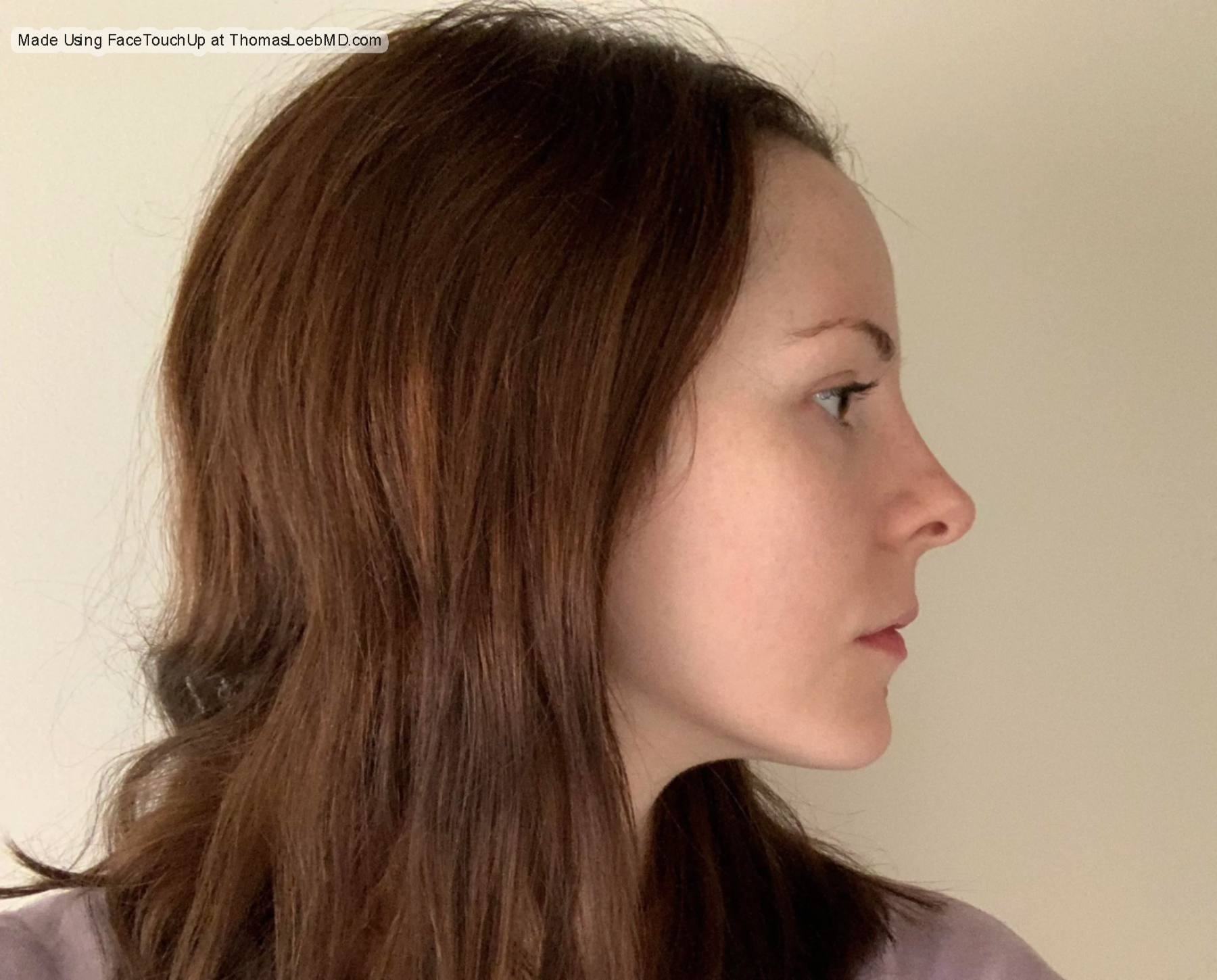 Example02