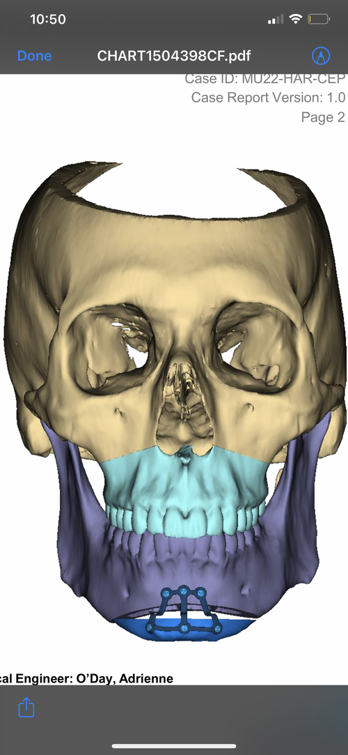 6DF2D0F4-9EA8-4F96-90F4-1DFA35899F36.png