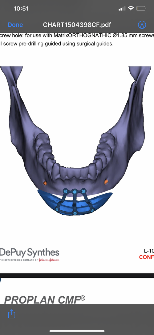823C6051-DE64-49EE-8405-366B2C9497A5.png