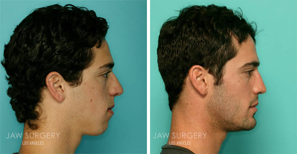 before-after-patients-15.jpg