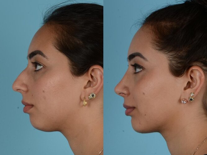 2019-May-Before-n-After-Update-2.jpg