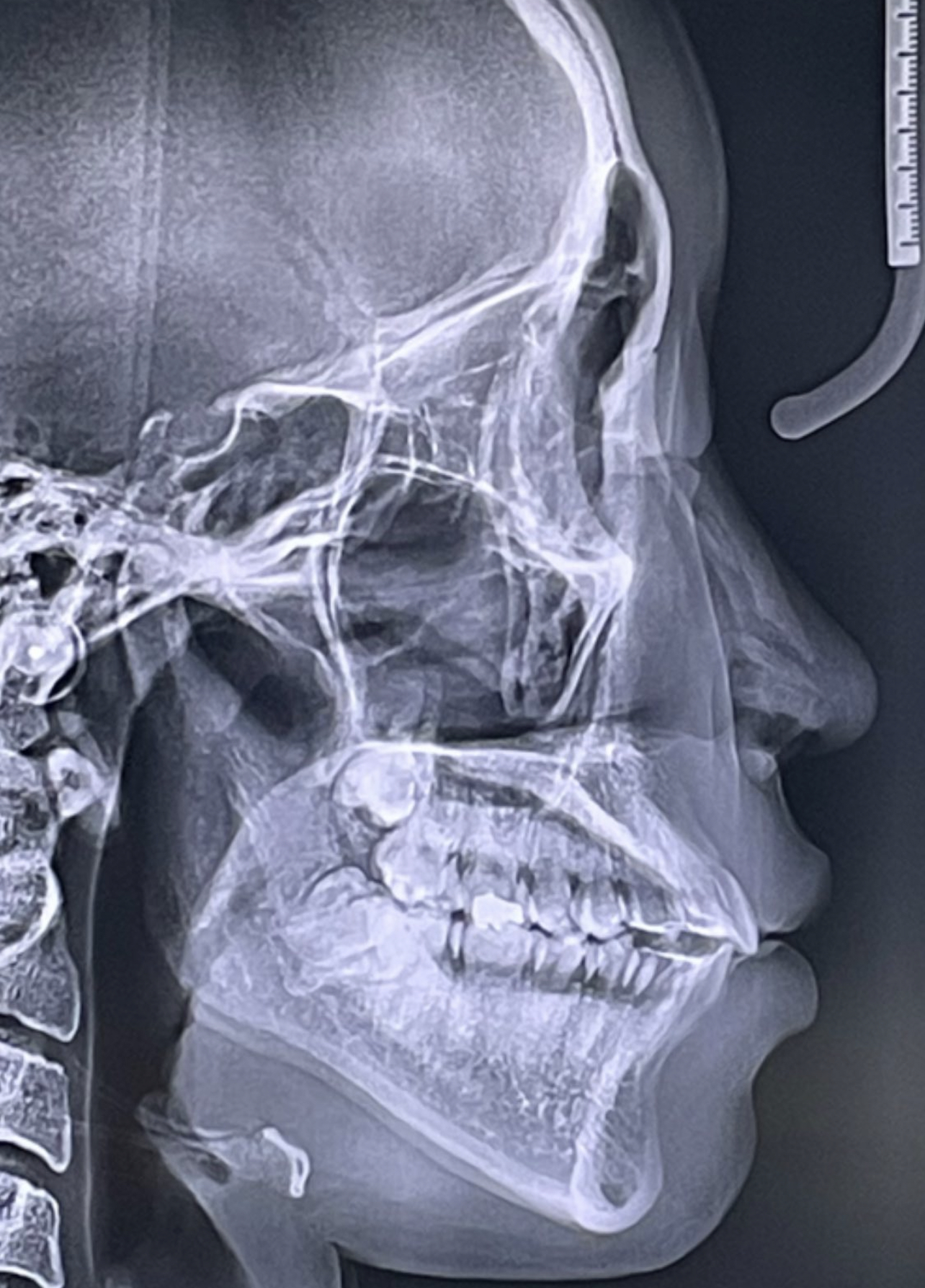 C82F141C 95DC 4407 9D0A 7DAFAFE625DF