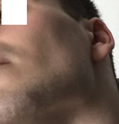 Sterno