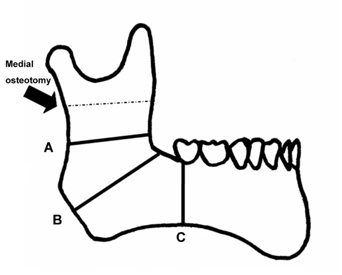 1651574614541