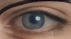 Eye