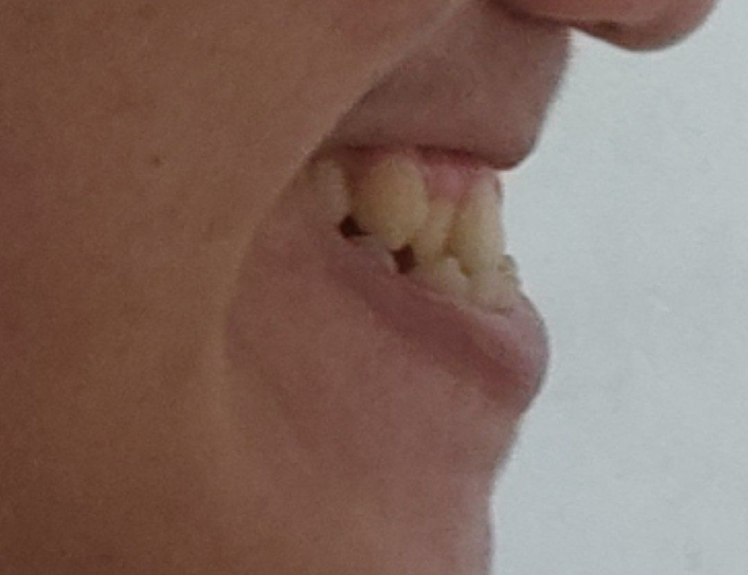 IMG 20220402 172636 083 1