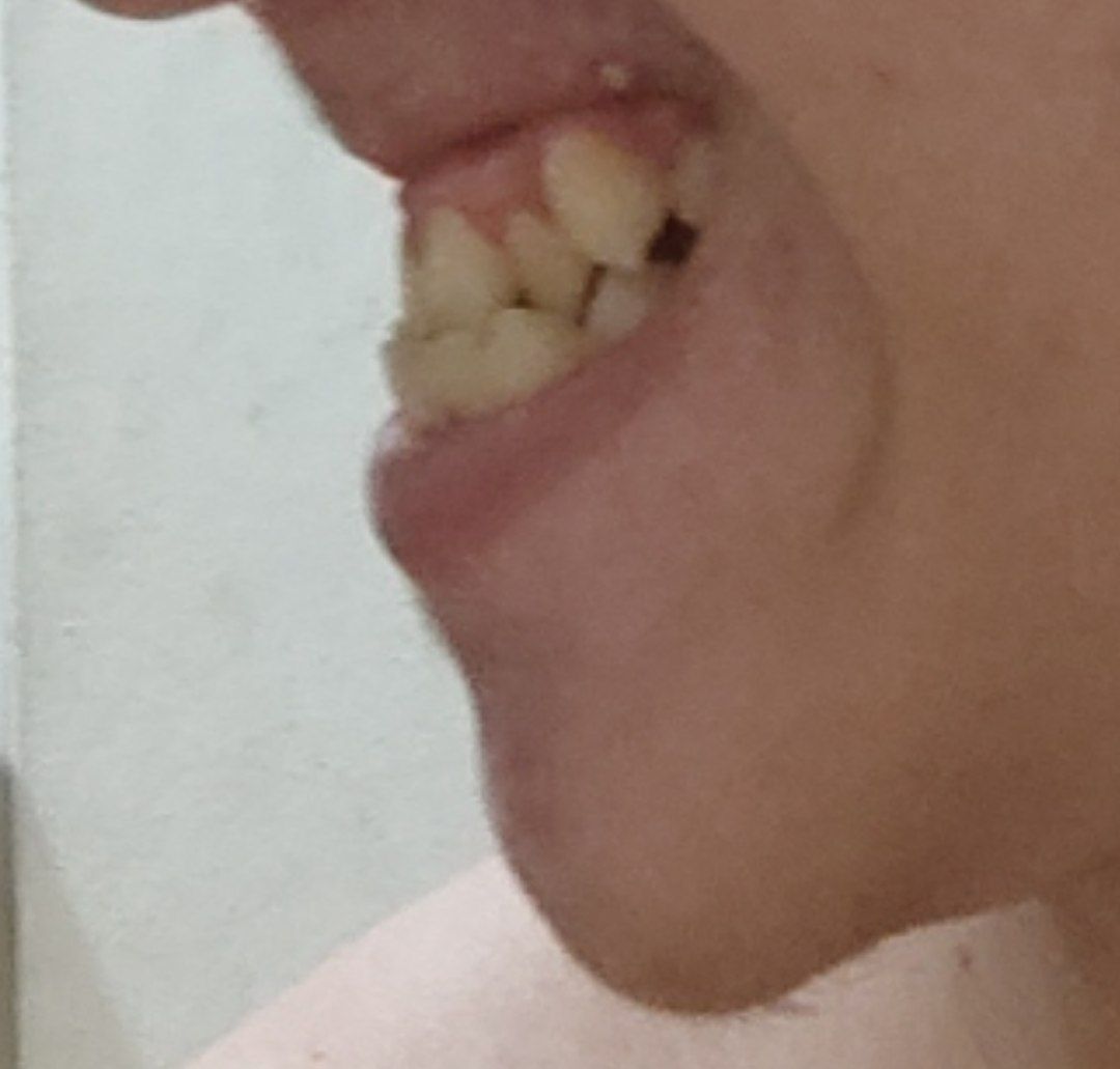 IMG 20220402 160143 569