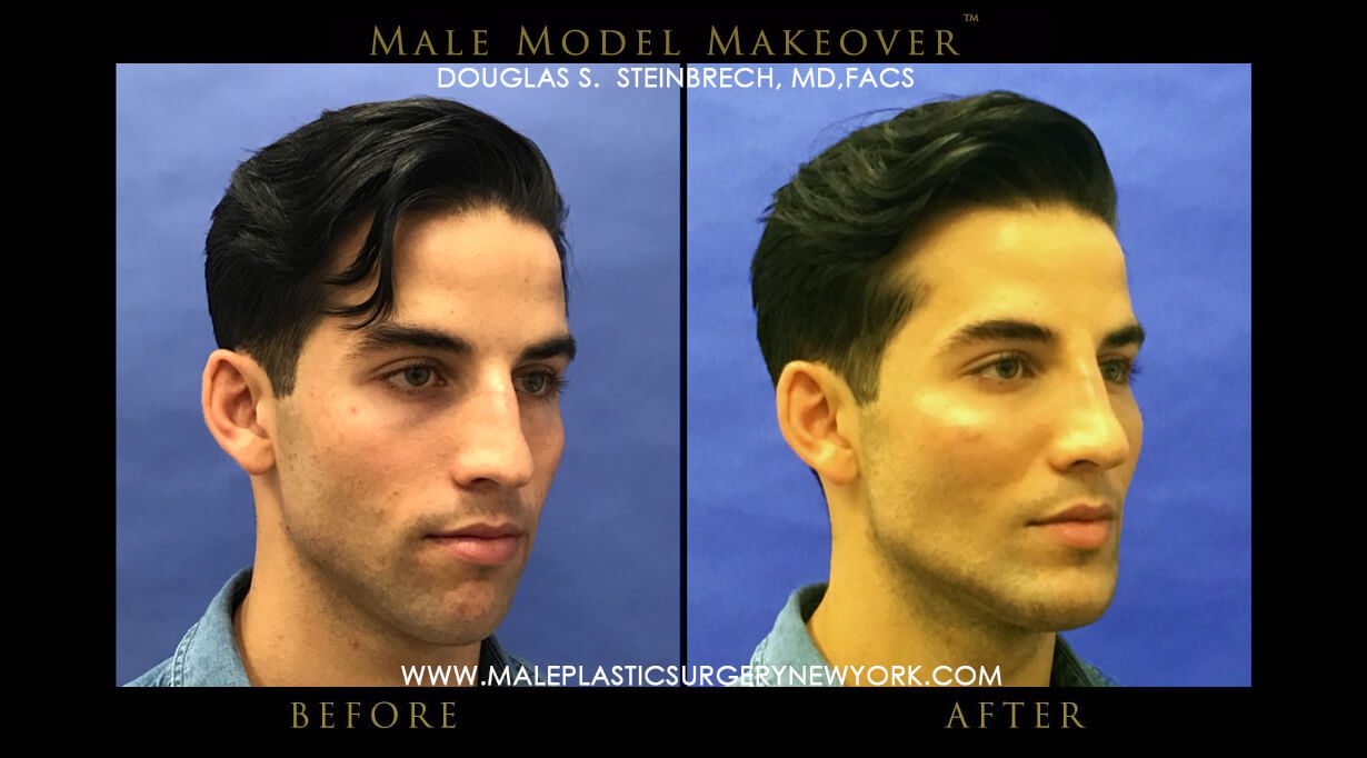 Male model