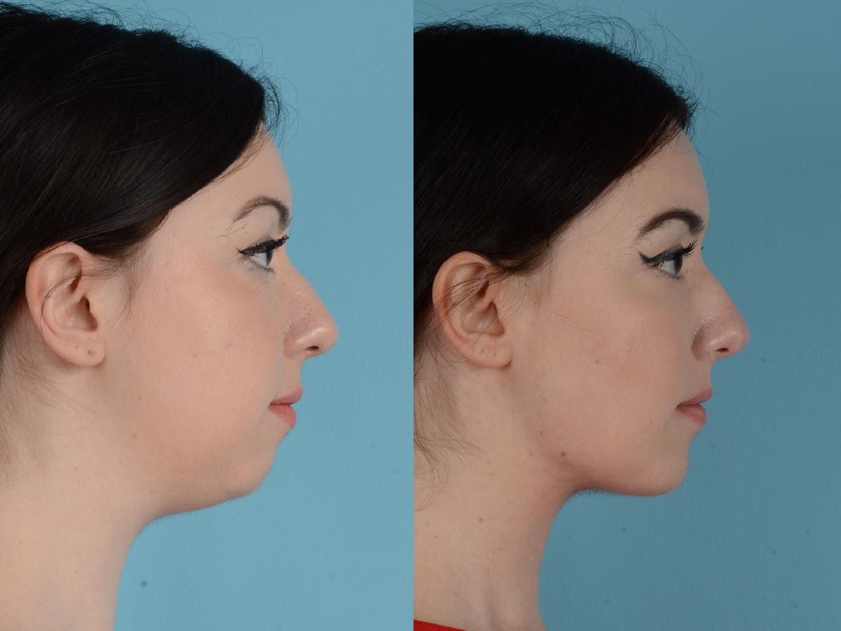 Profile