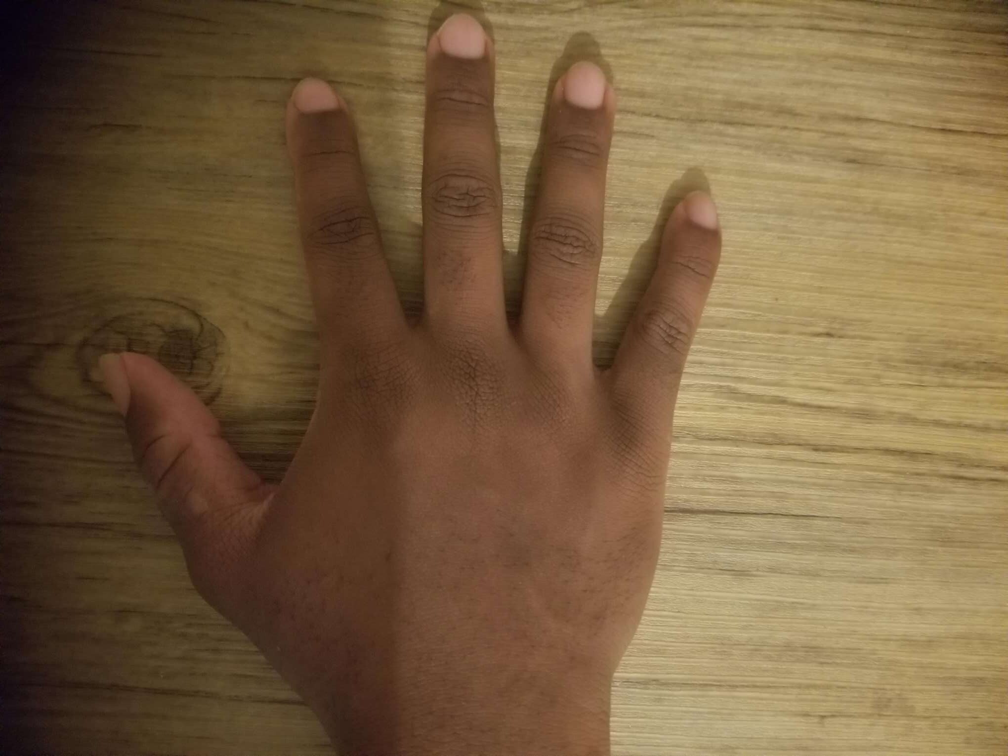 Hmmm
