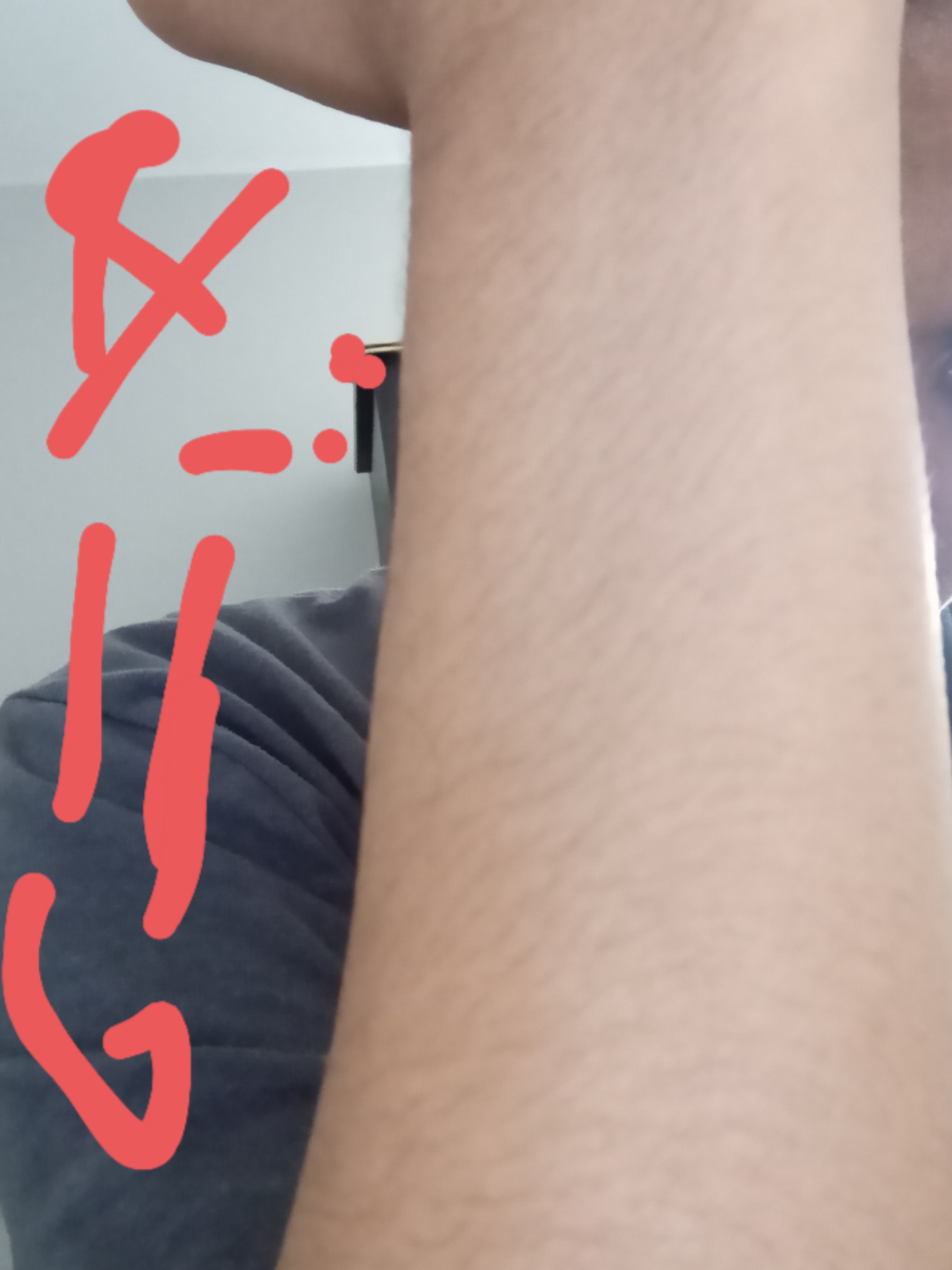 2873955 20220506 155844 mfnr