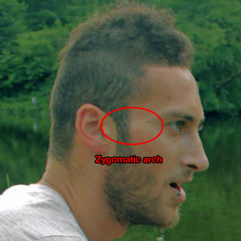 Zygomatic arch Zygomatic arch