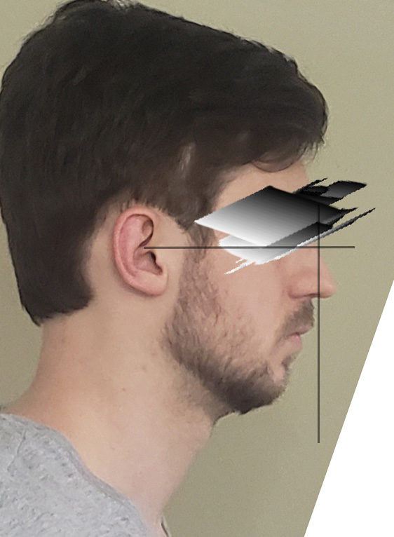 Ug1